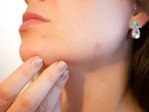 Dermatologie