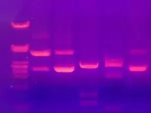 Elektrophorese