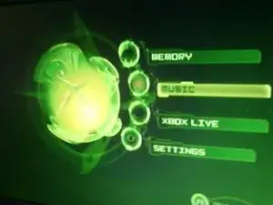 Xbox Festplattenverwaltung