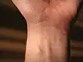 Ein Handgelenk von außen...