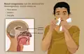 Ist die Nase verstopft, kann man zum Beispiel mit einem Nasenspray dafür sorgen, dass die Schleimhäute abschwellen.