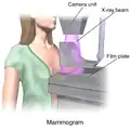 Eine Frau bei der Mammographie. Die Röntgenbilder zeigen, ob in der Brust eine Krebskrankheit gewachsen ist.