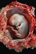 Ein Embryo, der acht Wochen alt ist