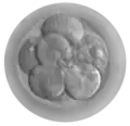 Embryo mit acht Zellen