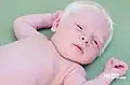 Dieses Baby hat Albinismus. Ohne Pigmente ist es ganz weiß.