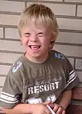 Ein Junge mit Down-Syndrom. Menschen mit dem Down-Syndrom haben die Chromosomen etwas anders.