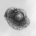 Das Varicella-Zoster-Virus sorgt für Windpocken.