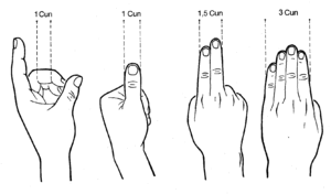 Akupunktur3.gif