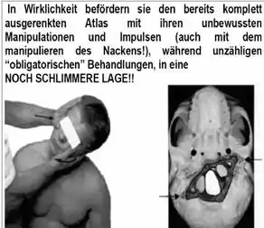 Atlasprofilax2.jpg