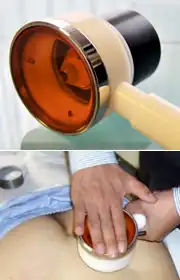 Chiroscanner.jpg