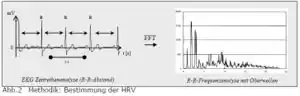 HRV2.jpg
