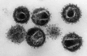 Hiv9.jpg