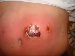Meso5.jpg