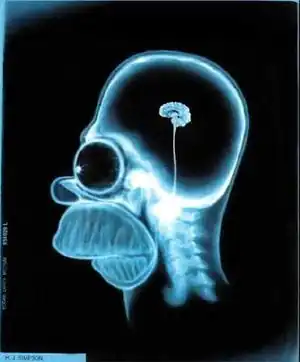 XrayHH.jpg