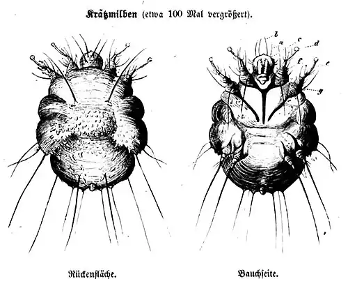 Die Gartenlaube (1857) b 055.jpg Krätzmilben (etwa 100 Mal vergrößert)