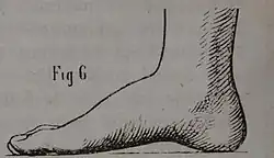 Die Gartenlaube (1863) b 071_3.jpg Fig. 6 Edle Fuß