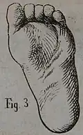 Die Gartenlaube (1863) b 071_4.jpg Fig. 3 Trampelfuß