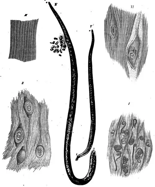 Die Gartenlaube (1864) b 108.jpg Freie und eingekapselte Trichinen