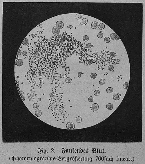 Die Gartenlaube (1879) b 063 2.jpg Fig. 2. Faulendes Blut