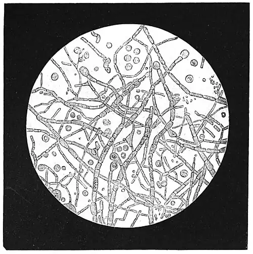 Die Gartenlaube (1879) b 508 1.jpg Fig. 4. Zahnpilze aus hohlen Zähnen.