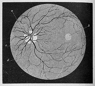Die Gartenlaube (1883) b 112 1.jpg Fig. 2. Der Augengrund durch den Augenspiegel gesehen
