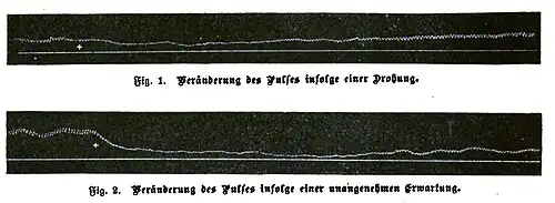 File:Die Gartenlaube (1899) b 0292_d.jpg Fig. 1. Veränderung des Pulses infolge einer Drohung. Fig. 2. Veränderung des Pulses infolge einer unangenehmen Erwartung