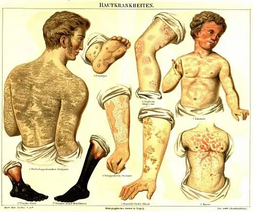 Hautkrankheiten