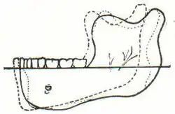 Abb. 1. Vergleichende Projektion der Umrißkurven von menschl. Unterkiefern aufeinander. Ausgezogen: fossiler Unterkiefer von Mauer; punktiert: zwei Unterkiefer v. austral. Ureinwohnern aus der Sammlung von Klaatsch.